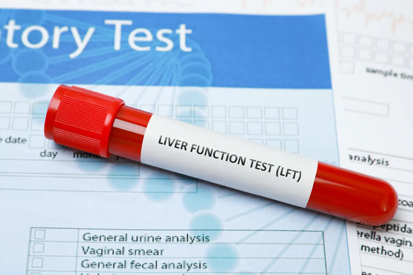 Blood sample labeled for liver function test (LFT) analysis.